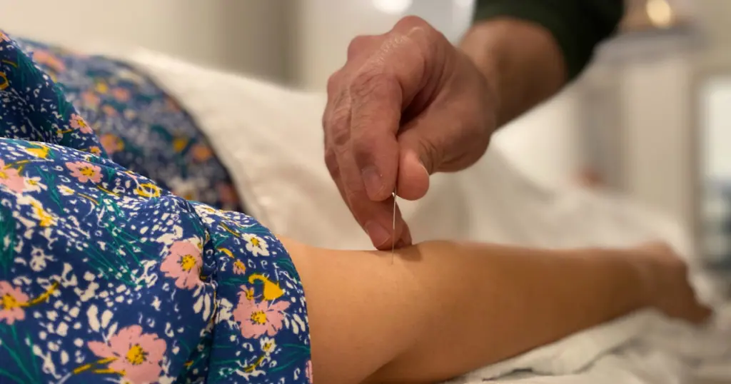 Acupuncture in Pregnancy